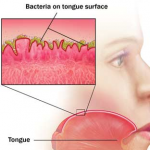 bacteriën tong